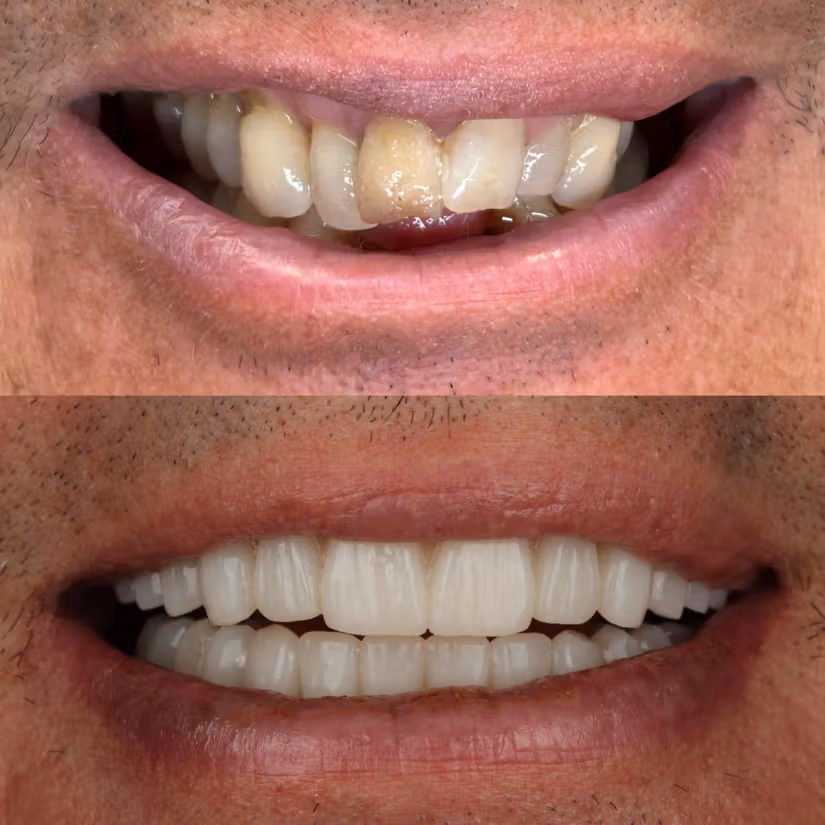 Dentsply Sirona digital dentistry scanner in a Dolan Dental treatment area